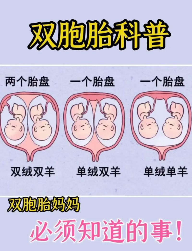 形容双胞胎的句子小学13对双胞胎新生世界上有12个双胞胎吗 汽车7